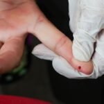 Brasil avança na eliminação da hepatite B