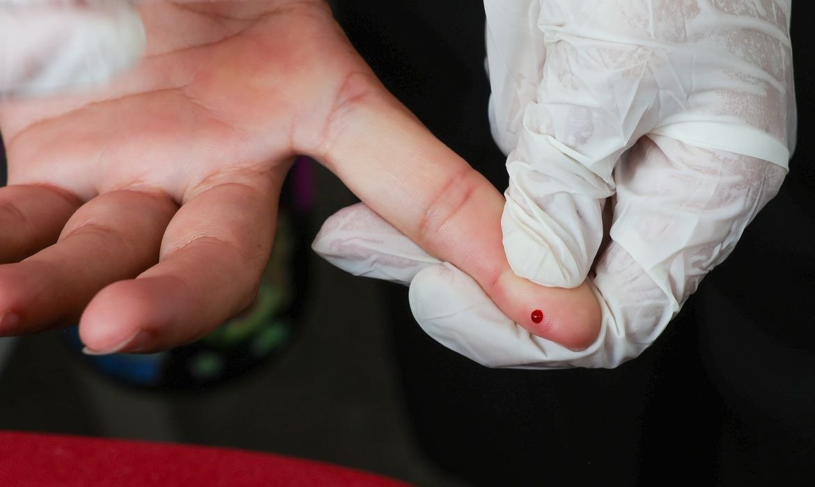 Brasil avança na eliminação da hepatite B