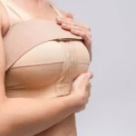 Cirurgias plásticas de mama no SUS voltam a crescer