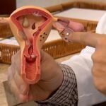 CNPq investe em pesquisas para ampliar diagnóstico da endometriose