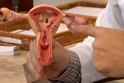 CNPq investe em pesquisas para ampliar diagnóstico da endometriose