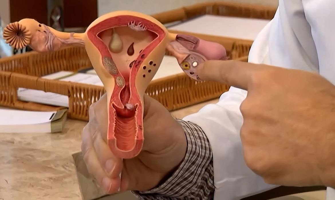 CNPq investe em pesquisas para ampliar diagnóstico da endometriose