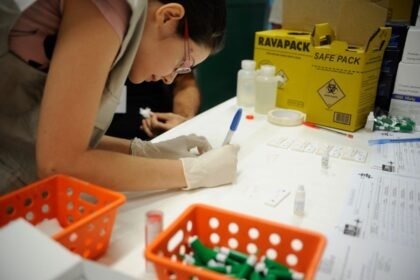 Hepatite E apresenta maior prevalência na Região Sul