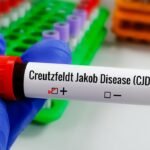Tipos de Creutzfeldt-Jakob: conheça as formas da doença