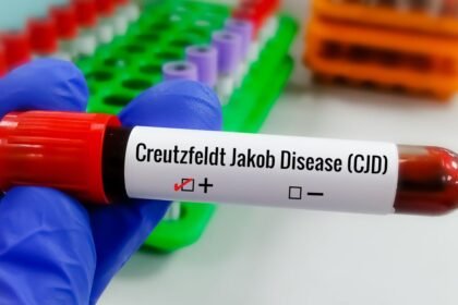 Tipos de Creutzfeldt-Jakob: conheça as formas da doença